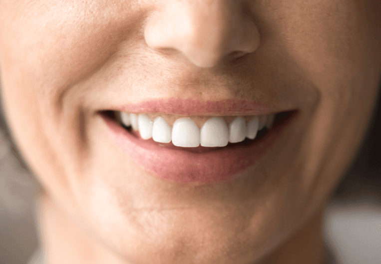 What is root canal therapy?